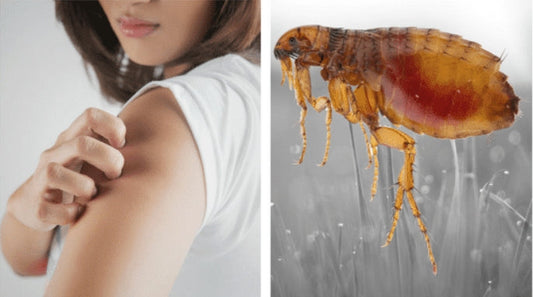 Fleas and UFO Flea Traps: How to Effectively Control Fleas
